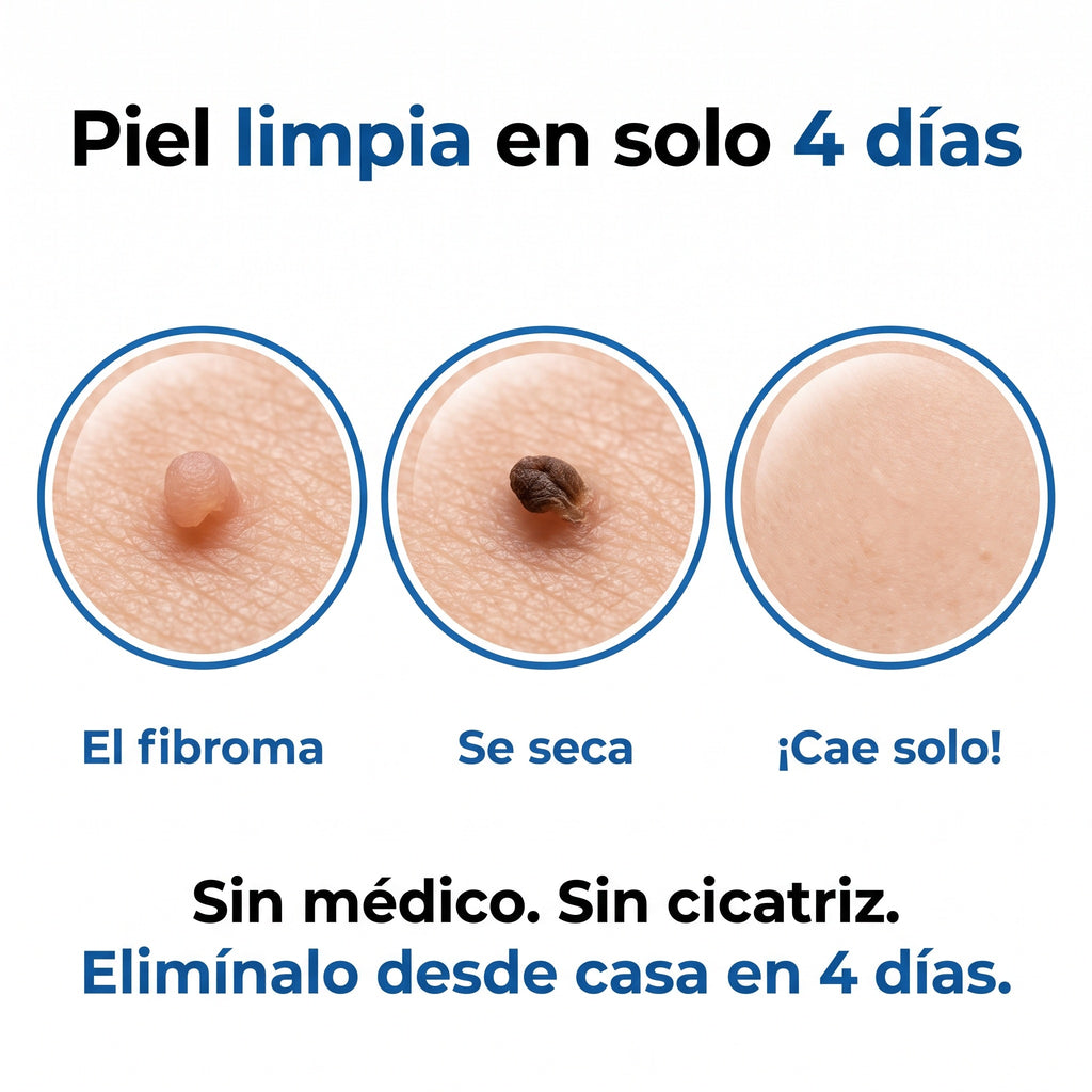 Nudex™ — Kit Eliminador de Fibromas
