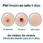 Nudex™ — Kit Eliminador de Fibromas